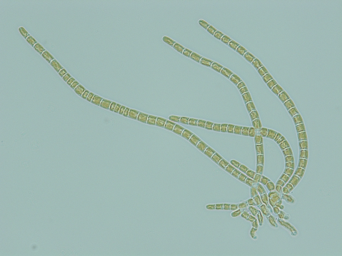 Algue Phaeosaccion multiseratum 
